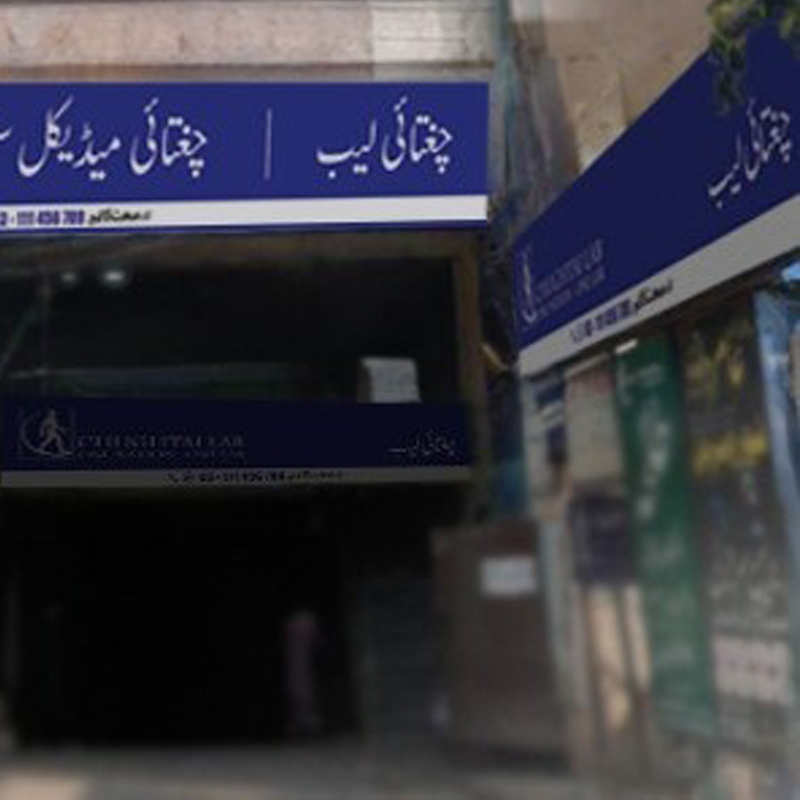 Chughtai Lab Multan Chughtai Lab Multan